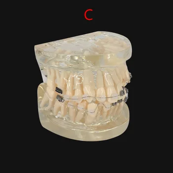 Dentare Îngrijire Orală Dinți Model Dentist Ortodontice Dintelui Model Demonstrativ Predare De Comunicare Medic-Pacient Rezultatele Arată