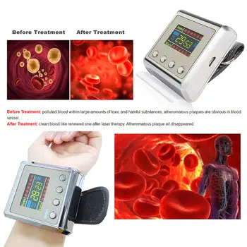 Terapia cu Laser 650nm Încheietura mâinii de Joasă Frecvență Diabet zaharat Hipertensiune arterială Tratamentul Colesterolului Diodă LLLT Ceas Terapia cu Laser Mașină